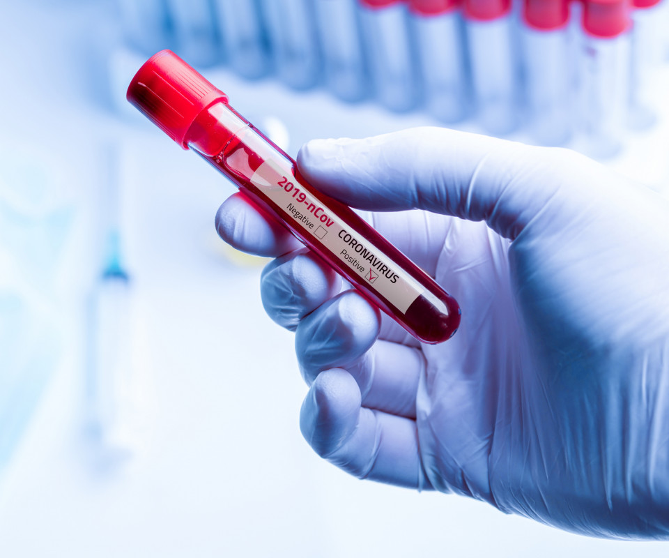 Test Covid : PCR, Antigénique, Sérologique - Tout comprendre