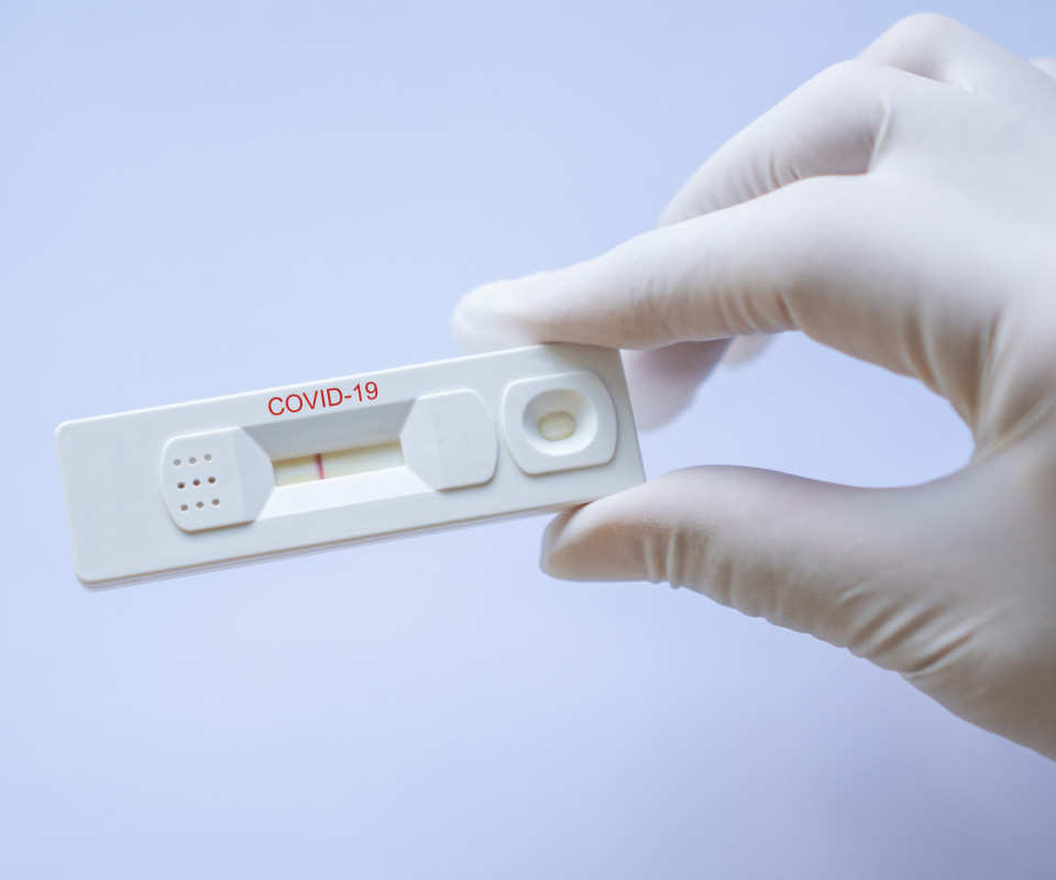 Santé / Test. Un test urinaire pour révéler les formes graves de la  Covid-19 ?