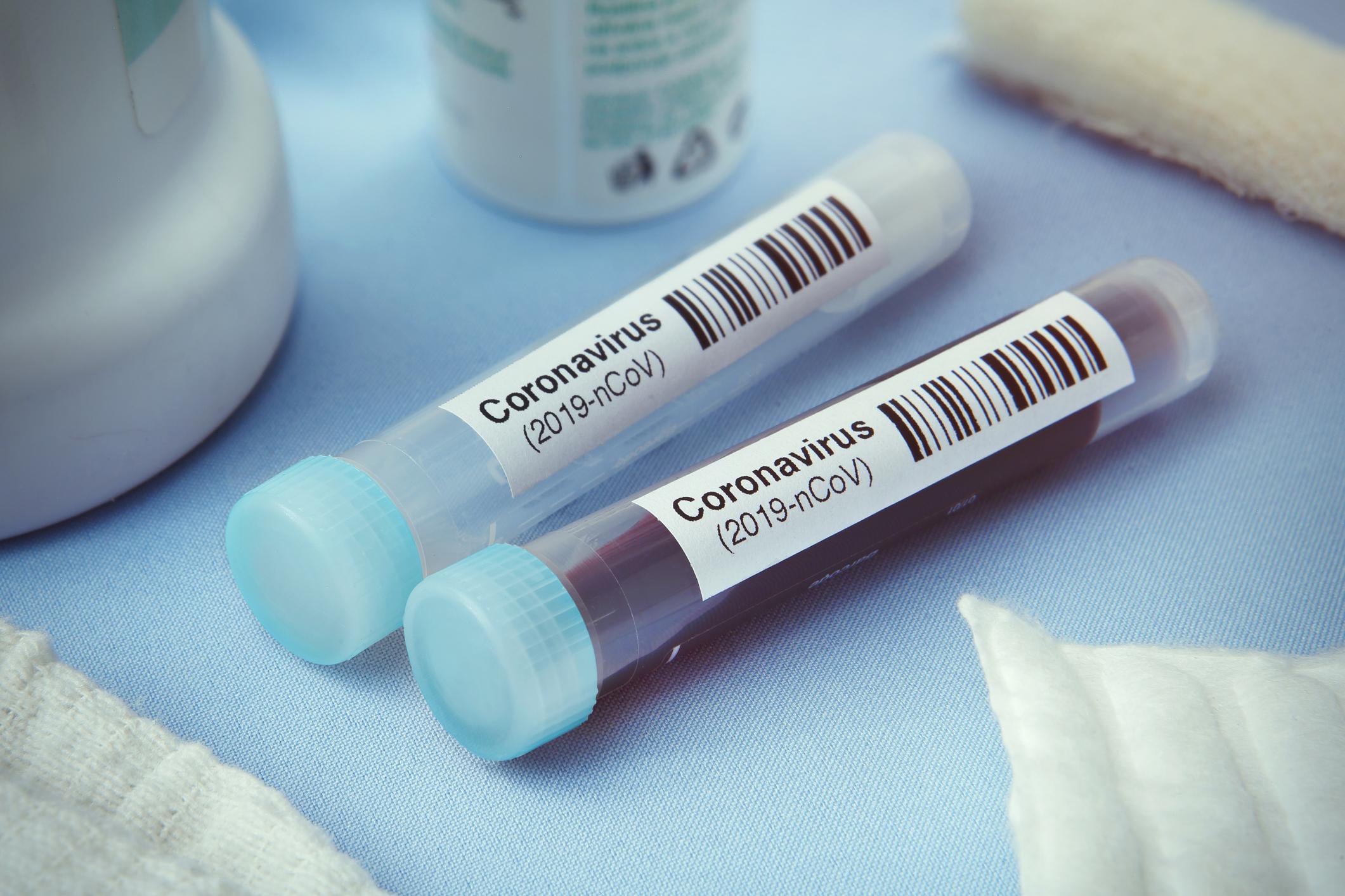 laboratoire-test-covid