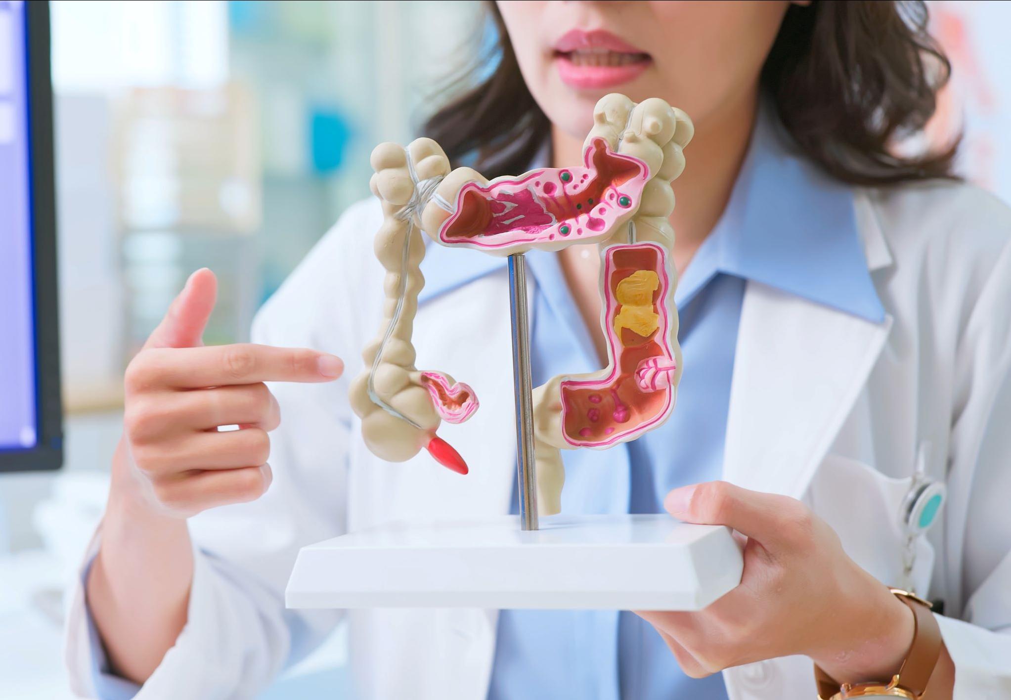 cancer-colorectal-cerballiance